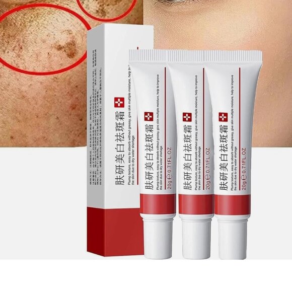 3PCS Dark Spot Whitening Cream Anti Freckle Face Cream - Picture 2 of 2